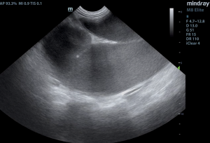 fluid_filled_pyo_structure_2020