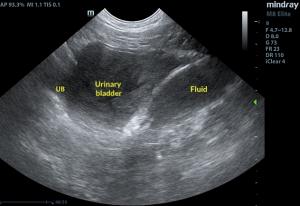 urinary_bladder_2020_im-0001-0030